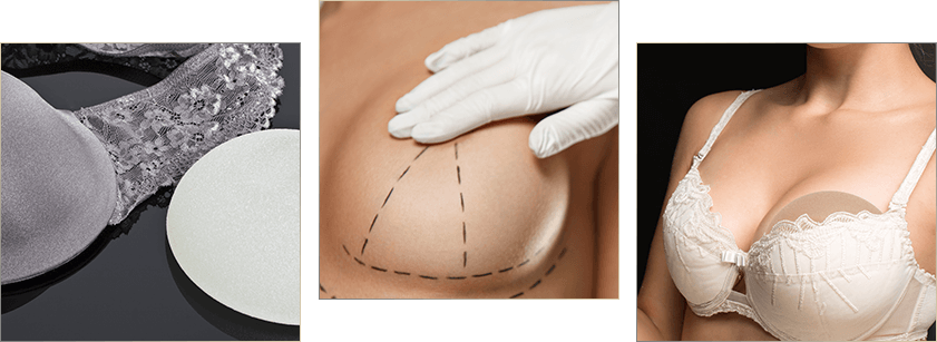 Breast Augmentation Surgery Beverly Hills - What To Expect