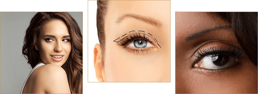 eyelid surgery benefits Beverly Hills