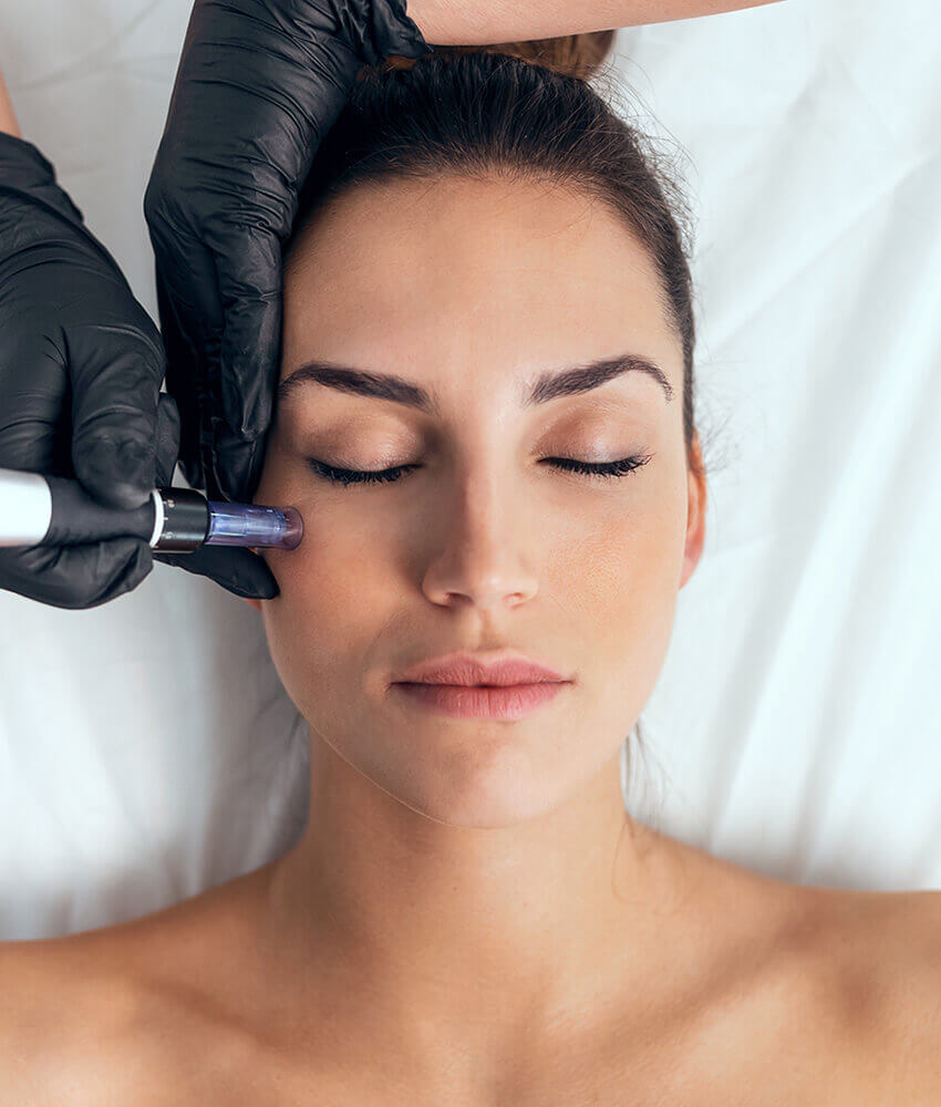 Woman getting microneedling done