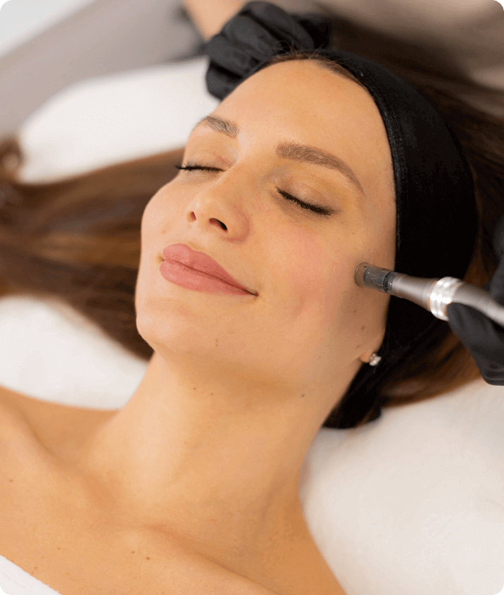 Woman getting a microneedling procedure done