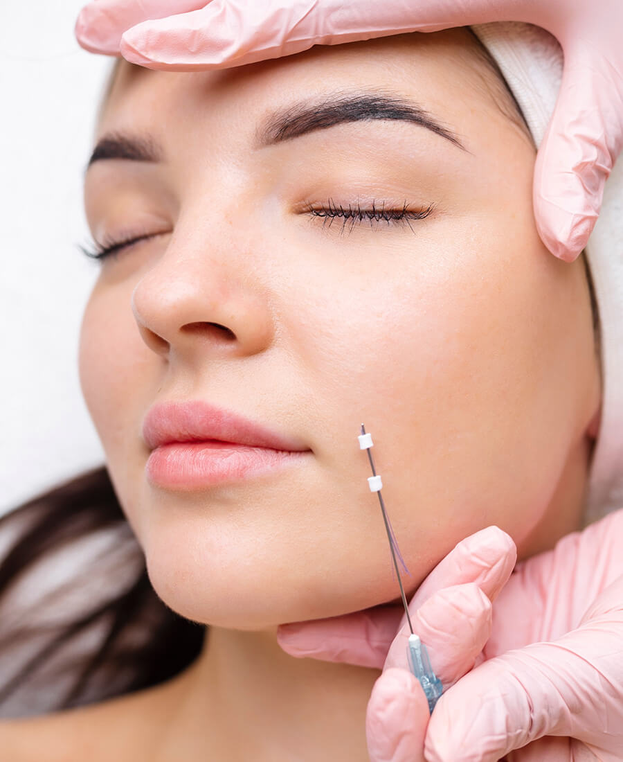 Woman getting a thread lift