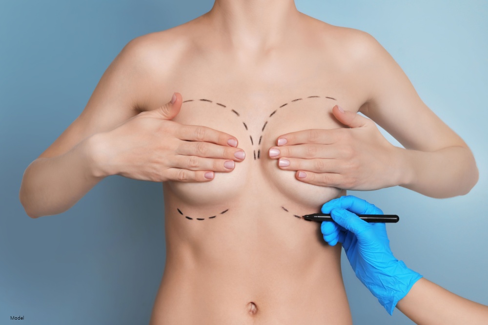 Dr. Gabriel ChiuFat Transfer Breast Augmentation Size Increase: How Much Bigger Can You Go?