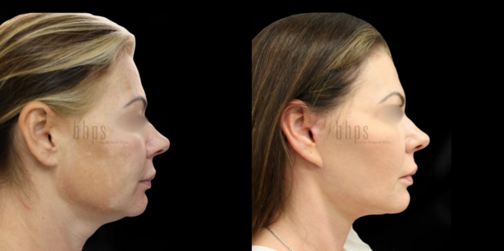 Actual Patient Results