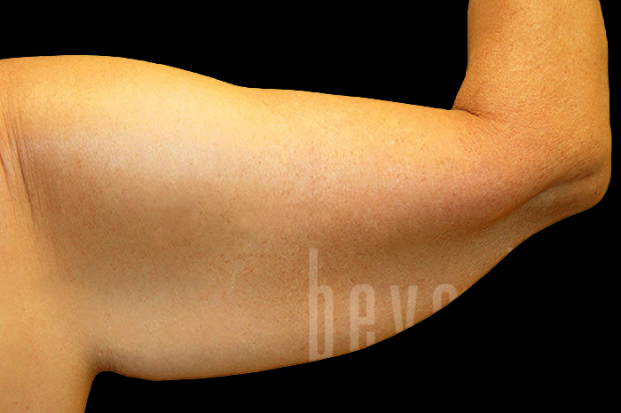 Case--9672 | Before Body