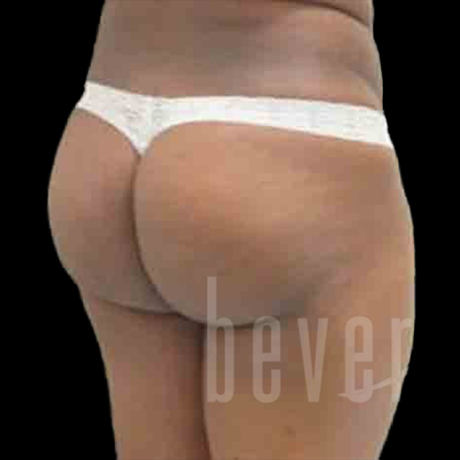 Case--9336 | Before Body