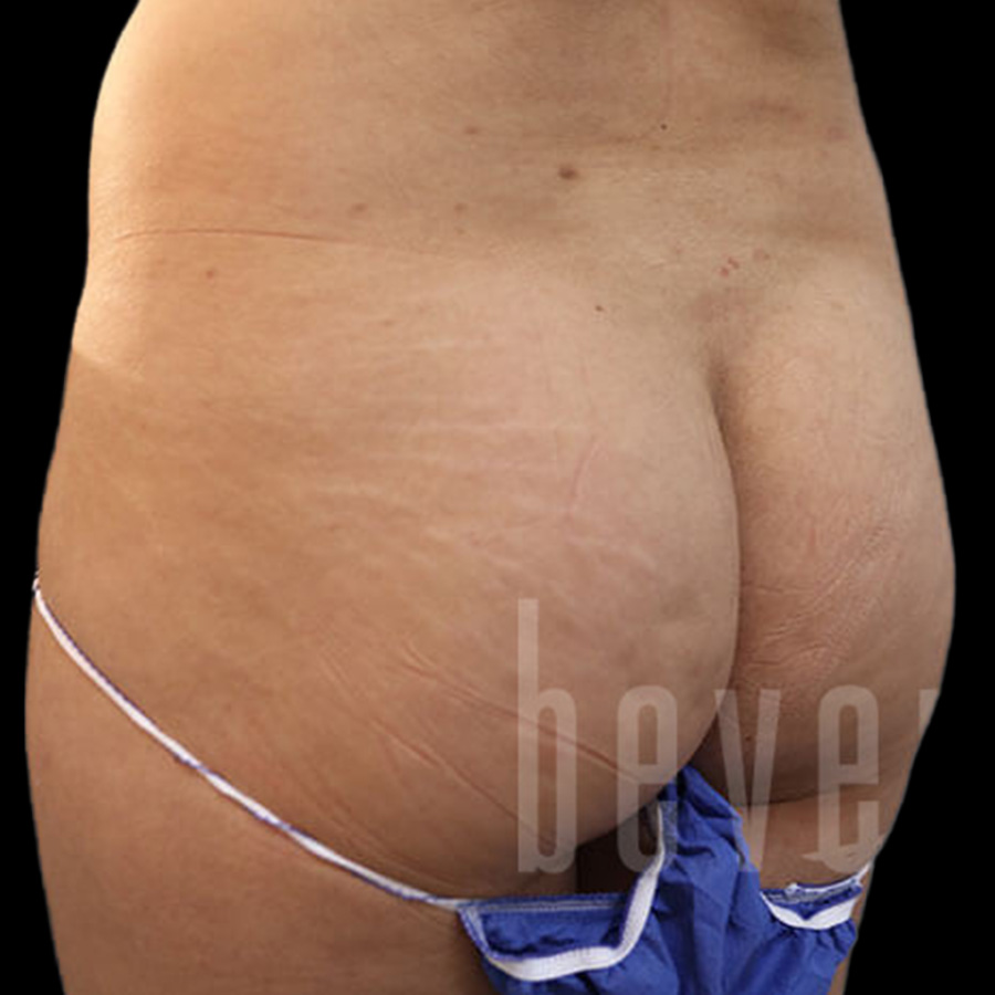 Case--7632 | Before Body