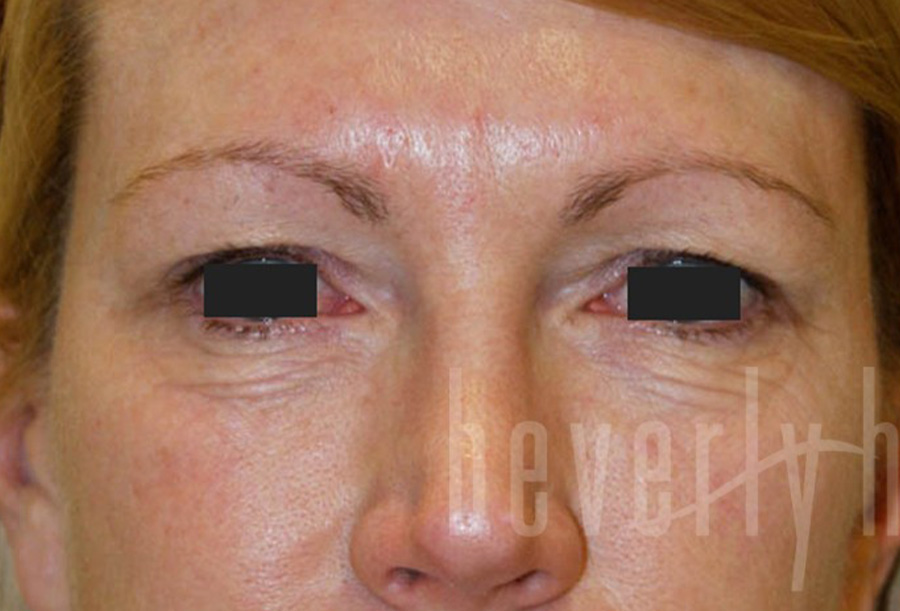 Case--2469 | Before Face