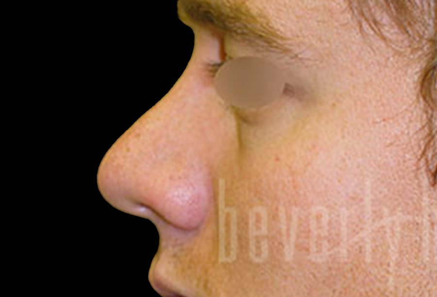 Case--2636 | Before Face