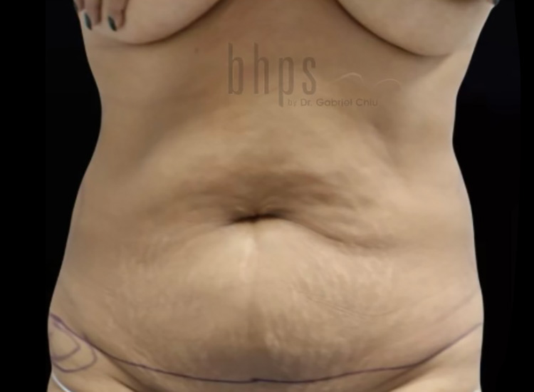 Case--1286 | Before Body