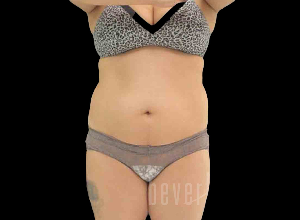 Case--4652 | Before Body