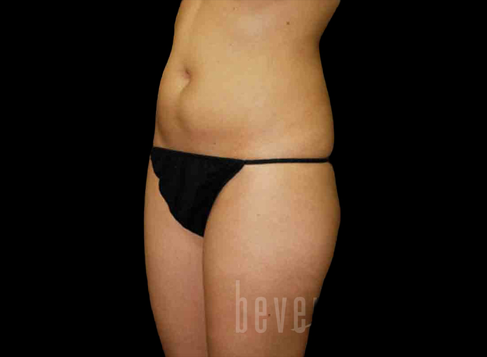 Case--7509 | Before Body