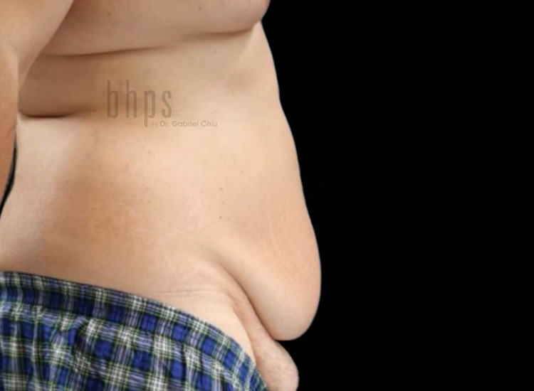 Case--4815 | Before Body