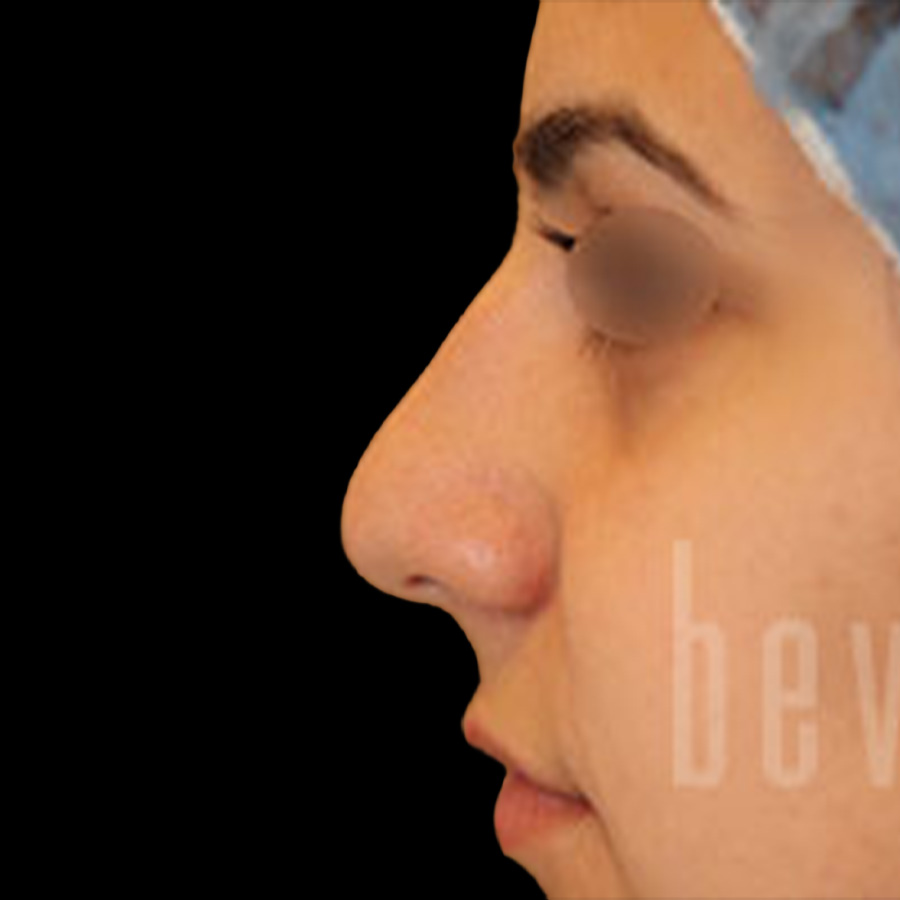 Case--7269 | Before Face