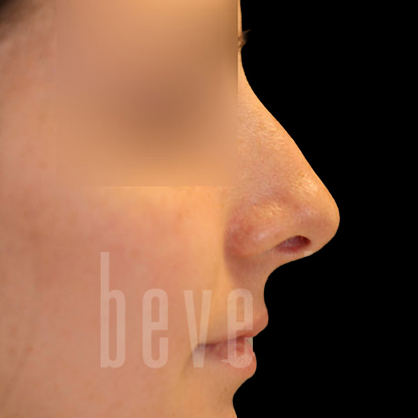 Case--4401 | Before Face