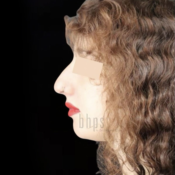 Case--9097 | Before Face