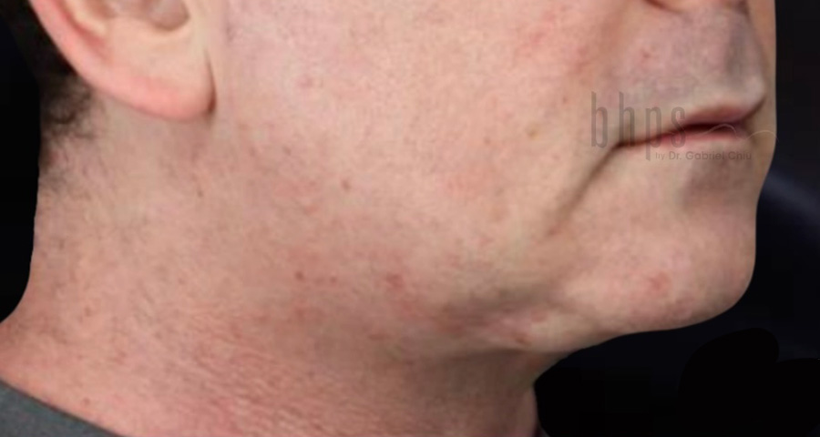 Case--8053 | Before SylfirmX 2