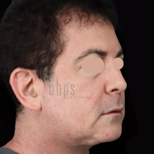 Case--8053 | Before SylfirmX