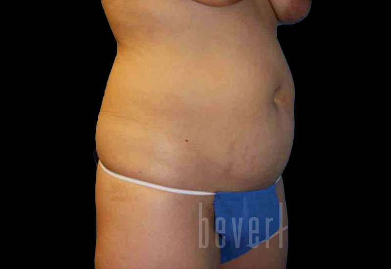 Case--9147 | Before Body