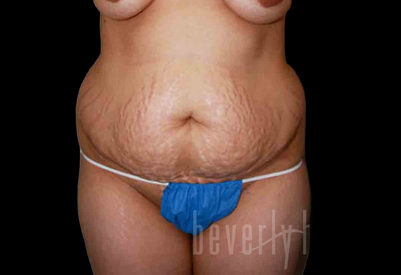 Case--9829 | Before Body